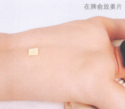 斑秃艾灸