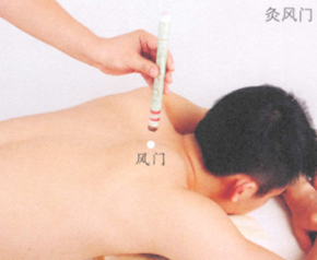 预防感冒艾灸