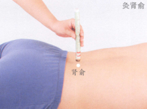 补肾强身艾灸