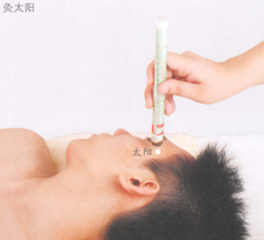 健脑益智艾灸