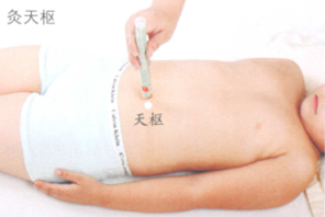 小儿保健艾灸