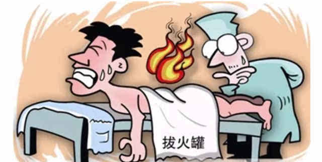 确保拔罐安全的四大步骤