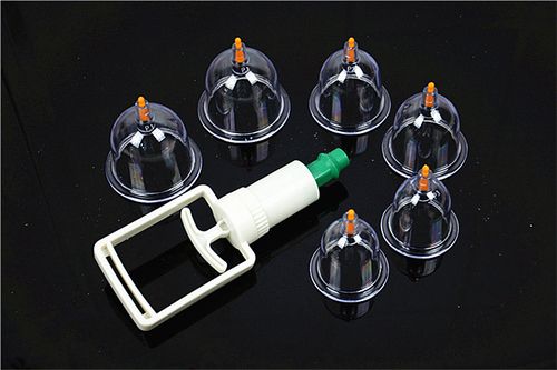 拔罐常用的罐具