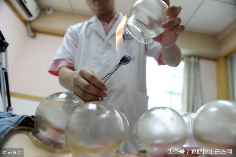 拔罐的常见反应及处理方法