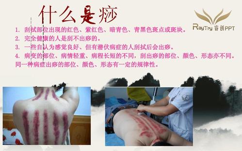 刮痧勿要片面追求出痧的颜色