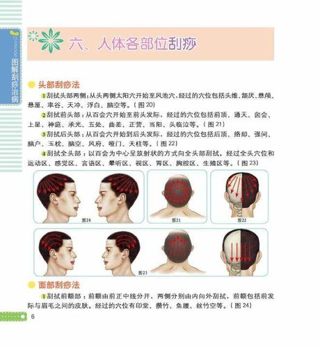 头痛刮痧疗法