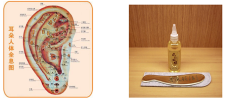 耳鸣刮痧疗法