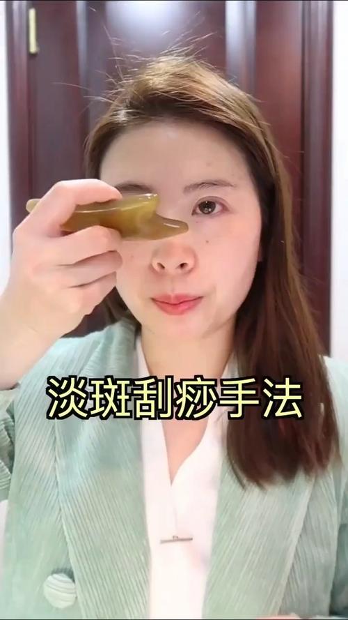 雀斑刮痧疗法