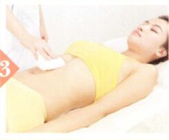 健脾养胃拔罐