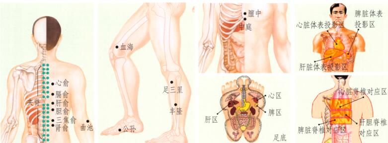 高脂血症刮痧