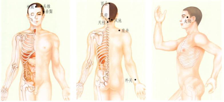 头痛刮痧