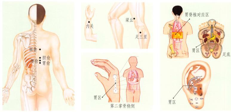 胃痉挛刮痧