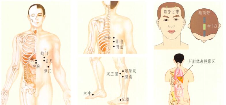 胆囊炎-胆石症刮痧