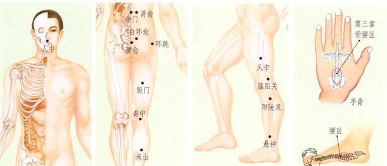 腰椎间盘突出刮痧