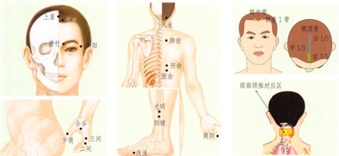 目赤肿痛刮痧