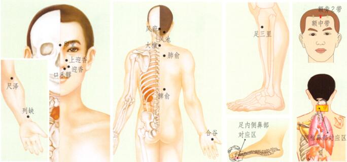 过敏性鼻炎刮痧