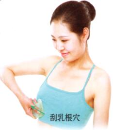 急性乳腺炎刮痧