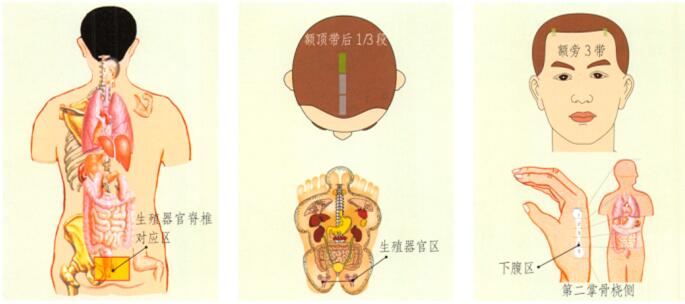 前列腺炎-前列腺肥大刮痧