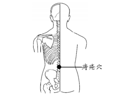 一个穴位治好了我多年的痔疮