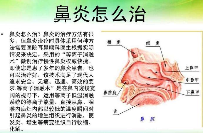 慢性鼻炎能除根吗，快速治疗鼻炎的方法