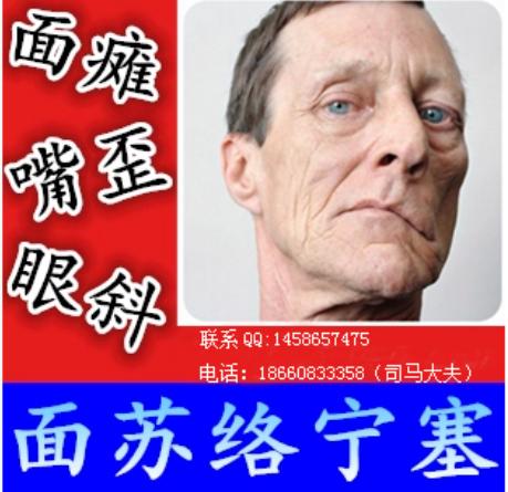 7种治面瘫的民间偏方，治疗最快的面瘫老偏方