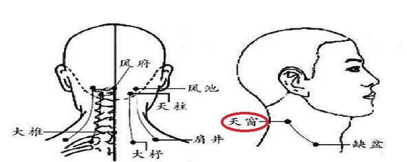 天窗在什么位置图