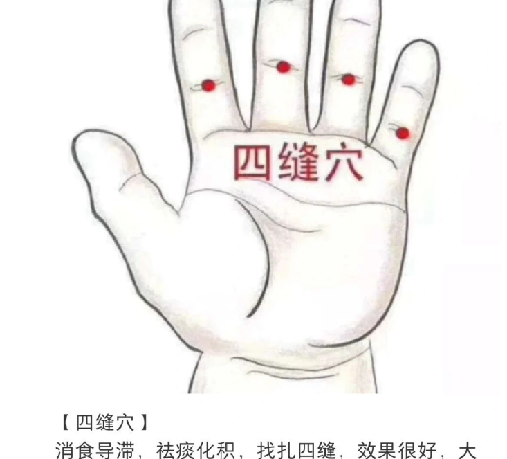 孩子挑食厌食怎么办？四缝穴有 “妙手回春” 之效