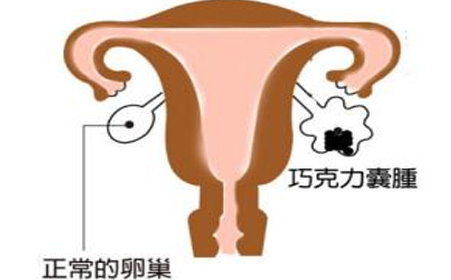 专治女性肿块、肌瘤、囊肿奇方