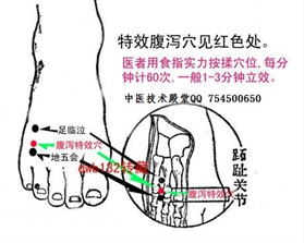 快速解除坐骨神经痛的穴位