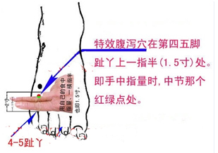 快速解除坐骨神经痛的穴位