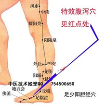 快速解除坐骨神经痛的穴位