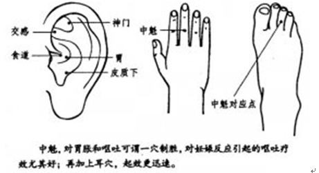 治呕吐、打咯——“中魁穴”
