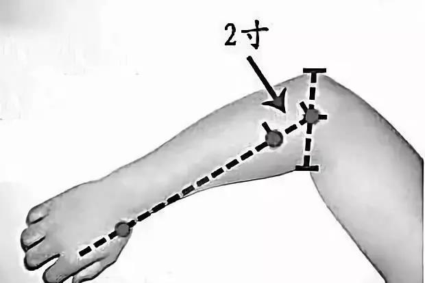 弹拨手三里和委中两穴可缓解闪腰