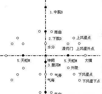 腹针疗法处方图