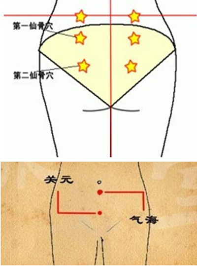 仙骨穴、肾俞穴、气海穴、关元穴和足三里穴