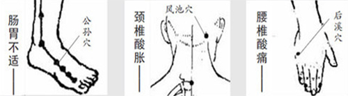 公孙穴，风池穴，后溪穴