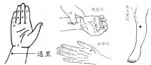 合谷、内关、通里、足三里