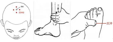 百会、四神聪、三阴交、太冲