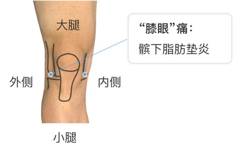 膝盖疼痛的位置和对应调理！