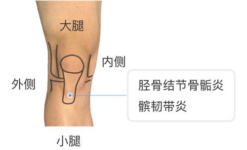 膝盖疼痛的位置和对应调理！