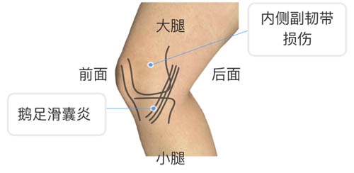 膝盖疼痛的位置和对应调理！