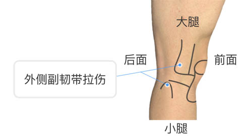 膝盖疼痛的位置和对应调理！