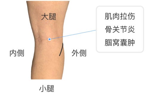 膝盖疼痛的位置和对应调理！