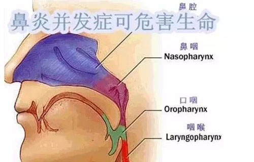 鼻炎的危害