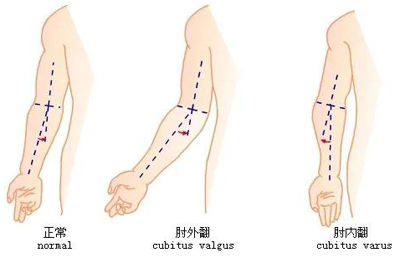 脊柱与四肢特殊检查法