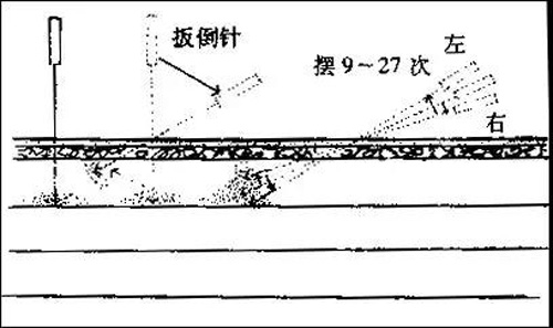 “飞经走气”四法