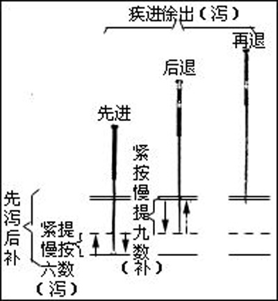 针灸治病八法