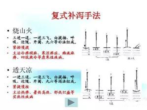 针灸时如何区分“天、地、人三才”？