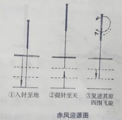 针灸时如何区分“天、地、人三才”？