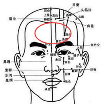 前额疼